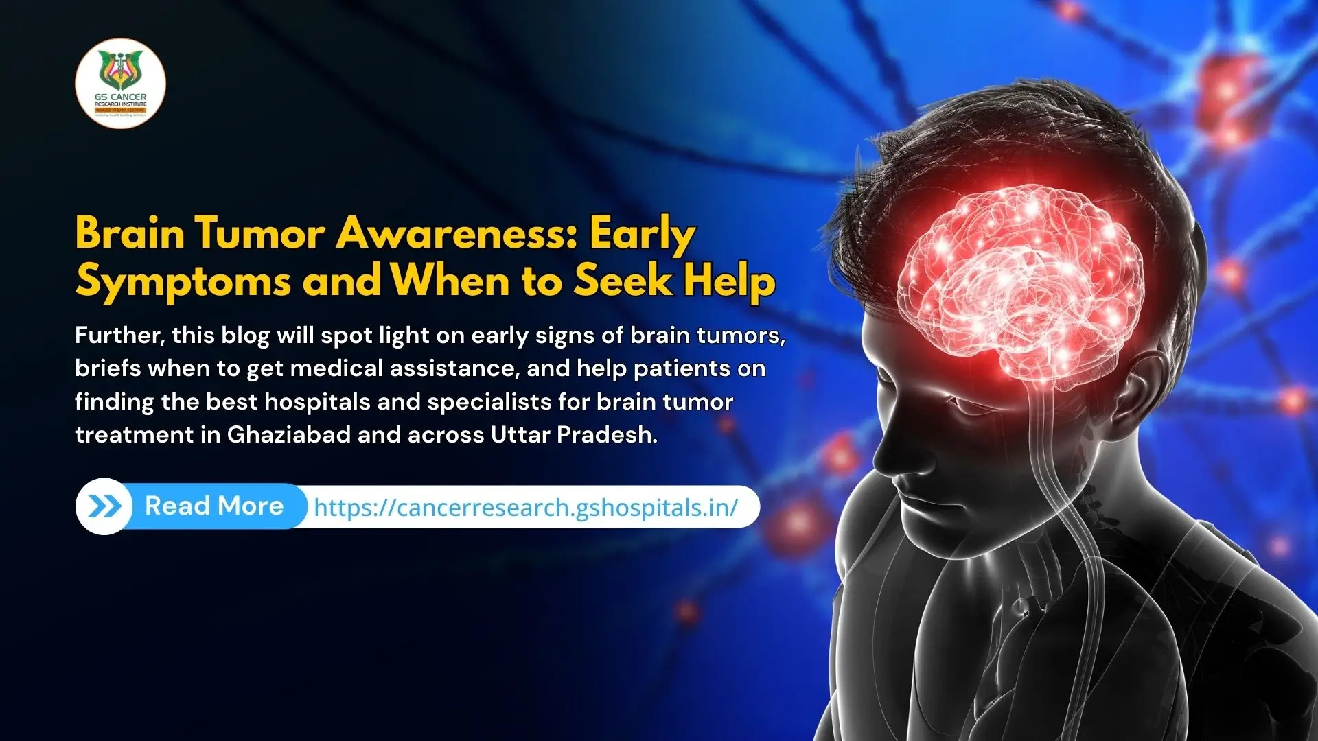 Brain Tumor Awareness: Early Symptoms and When to Seek Help