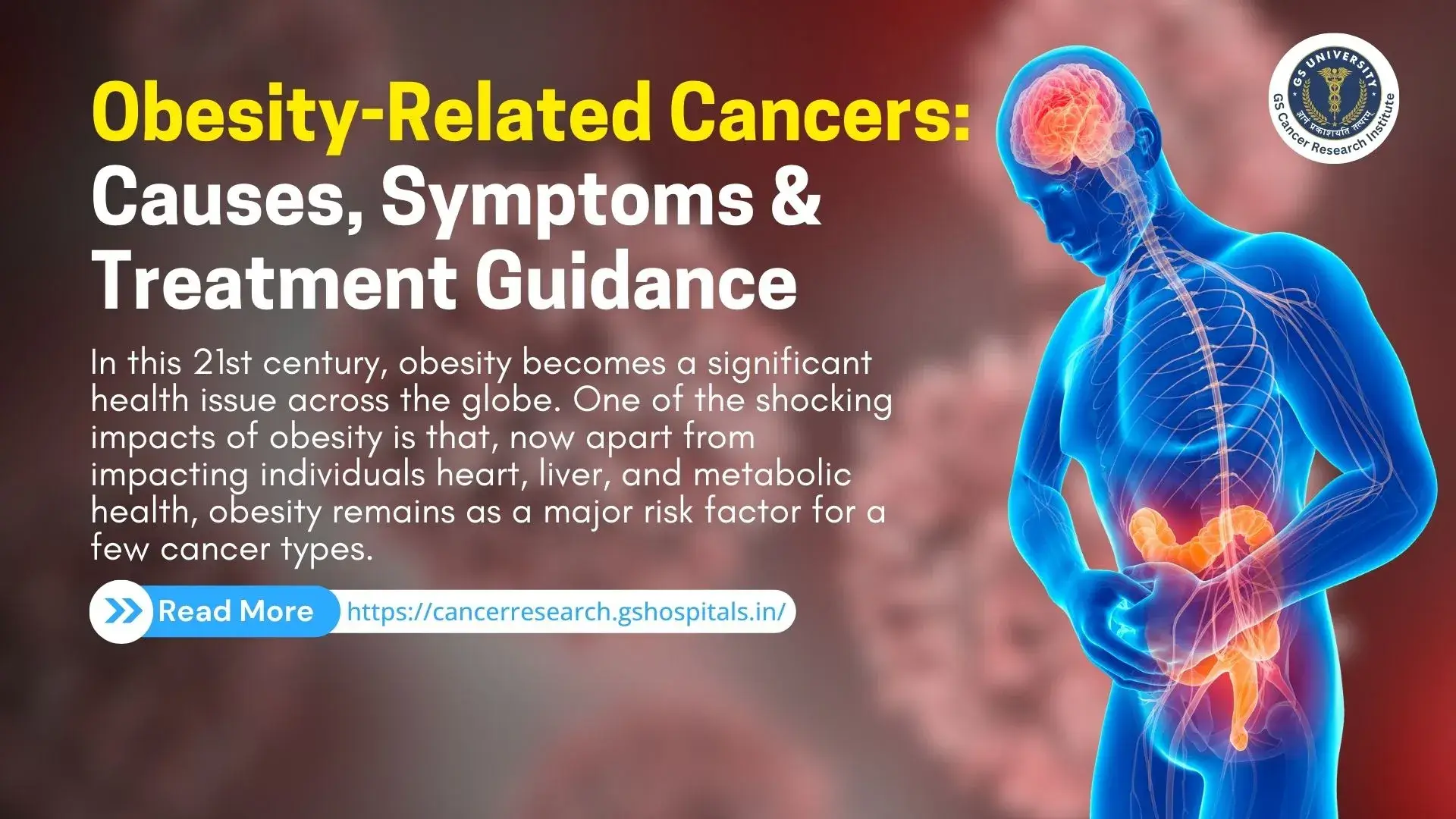 Obesity-Related Cancers: Causes, Symptoms & Treatment Guidance
